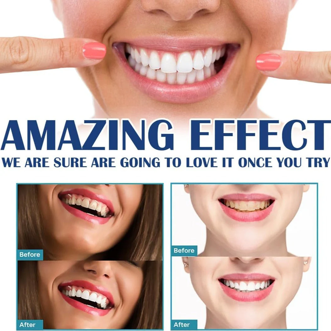 BrightSmile™ Zahnaufhellungs-Stift | 1+1 GRATIS - Image 3