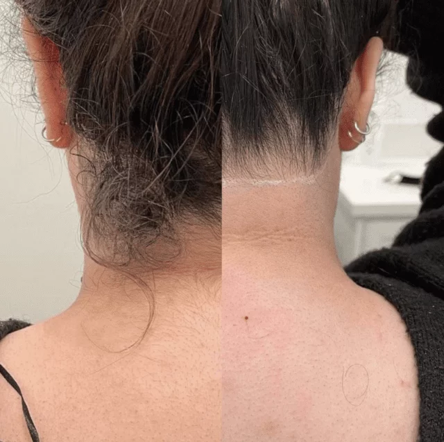 SmoothGlow 30 ML - Effektiver Haarentfernungsschaum | 1+1 GRATIS - Image 4