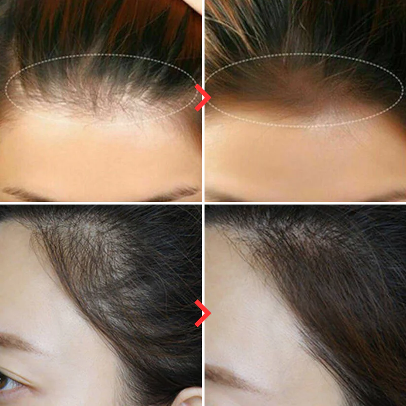 HairFix | Haarfüller-Pulver™ (1+1 GRATIS) - Image 5