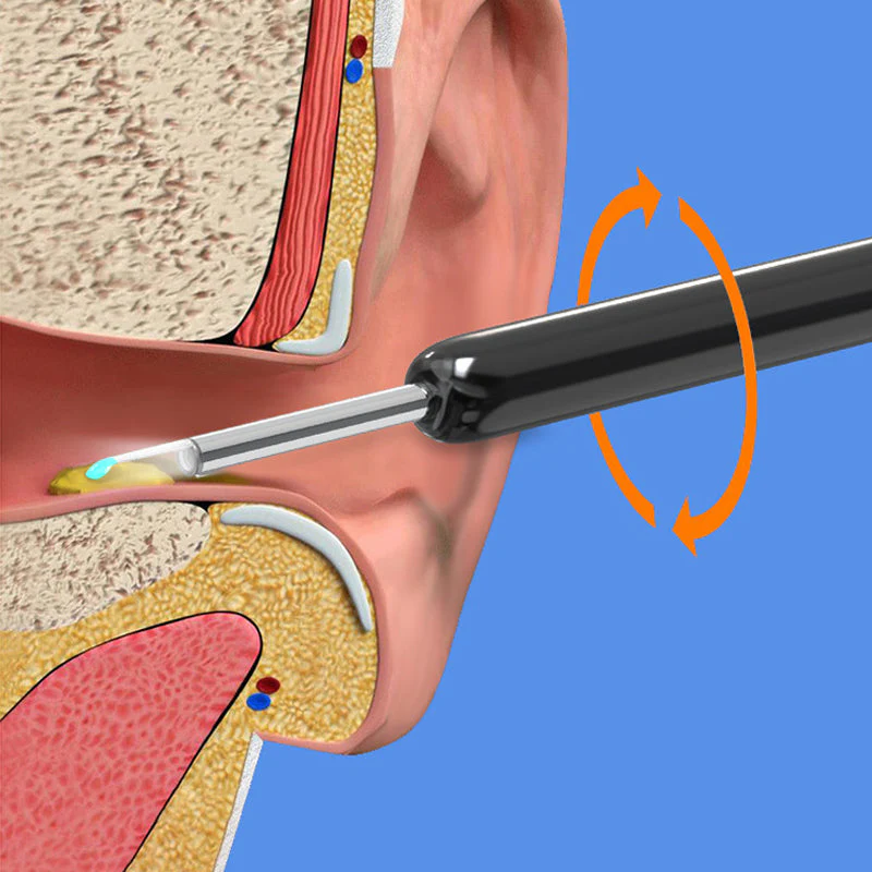 Intelligenter sichtbarer Earpick - Image 9