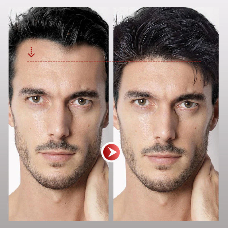 InvisiHair™ Männer-Stirnhaar-Toupet Soforthilfe - Image 6