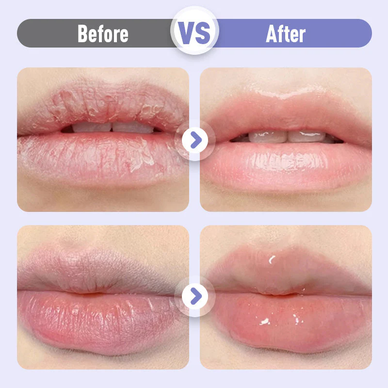 LushVive – Aufpolsterndes Lippenserum | 1+1 GRATIS - Image 11