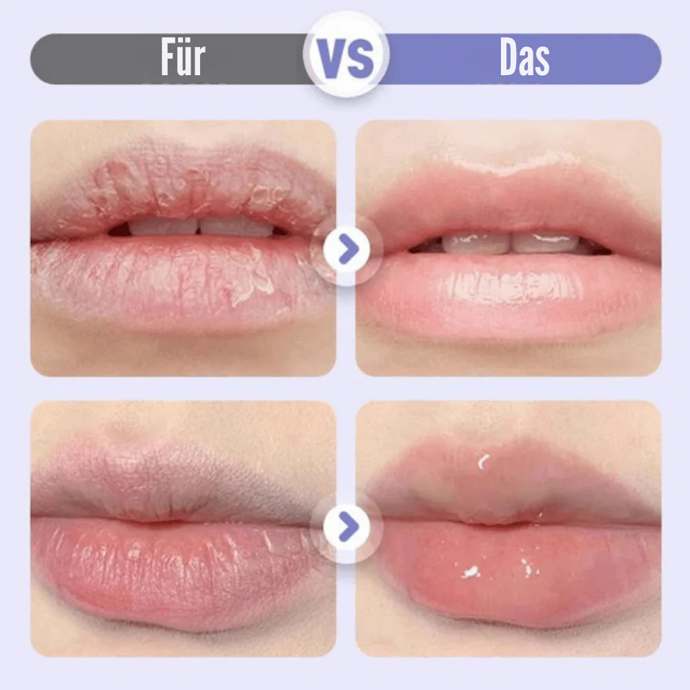 LushVive – Aufpolsterndes Lippenserum | 1+1 GRATIS - Image 3