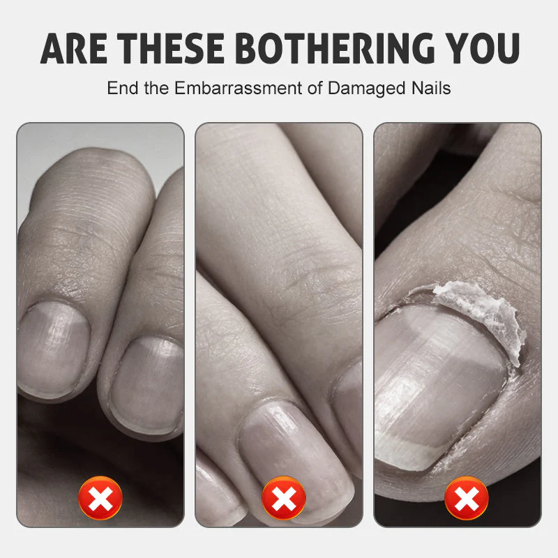 NailRevive – Stärkendes Nagelspray | 1+1 GRATIS - Image 12