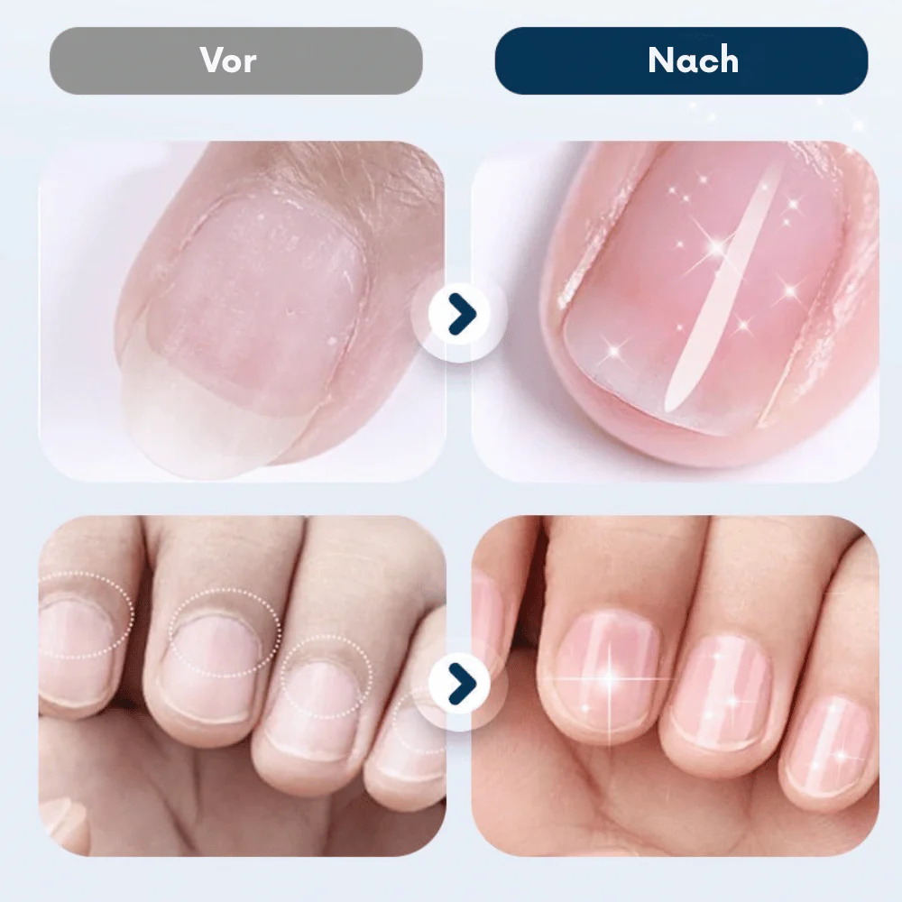 NailRevive – Stärkendes Nagelspray | 1+1 GRATIS - Image 4
