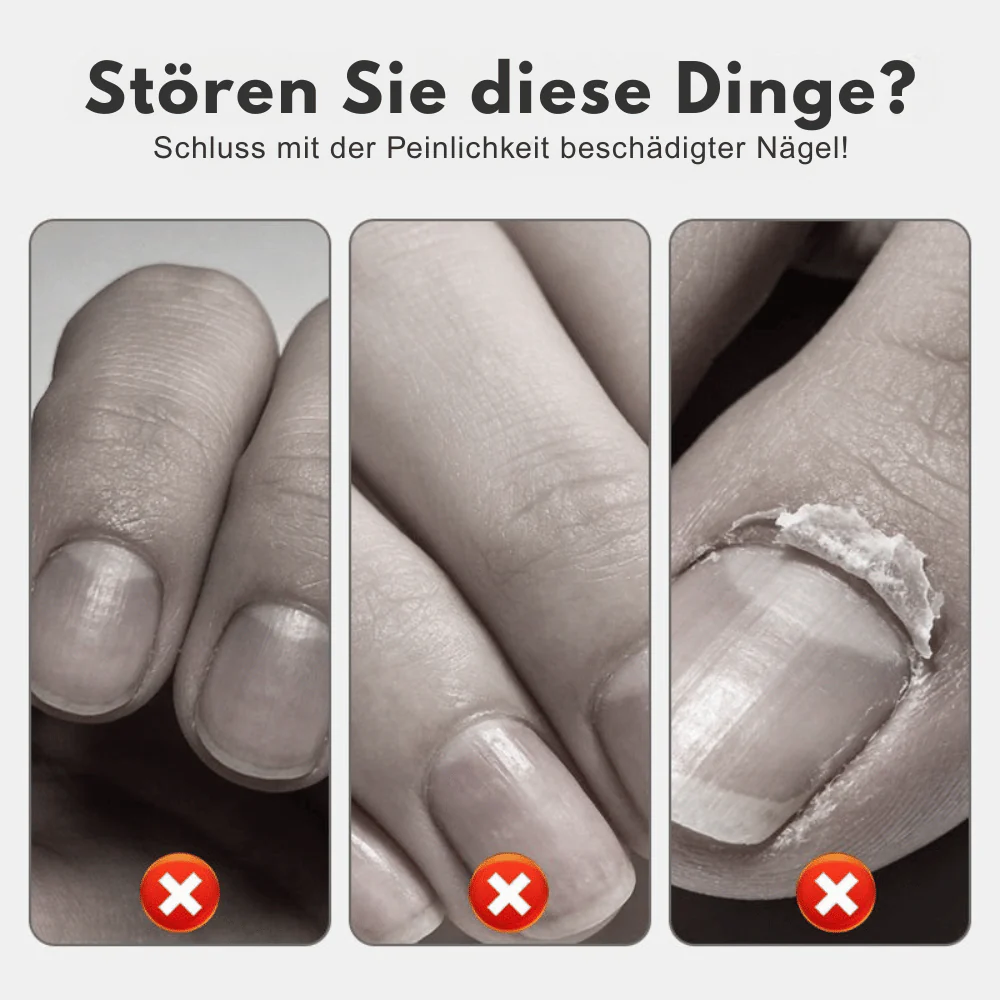 NailRevive – Stärkendes Nagelspray | 1+1 GRATIS - Image 5