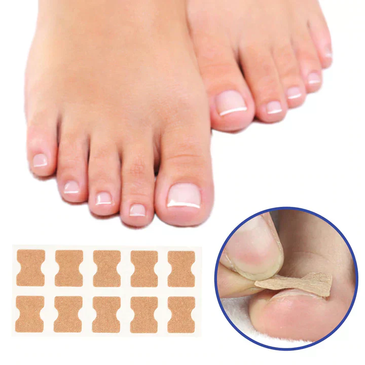 NailHeal™ 50+50 Stück GRATIS – Sofortige Schmerzlinderung und schnellere Heilung beschädigter Nägel!