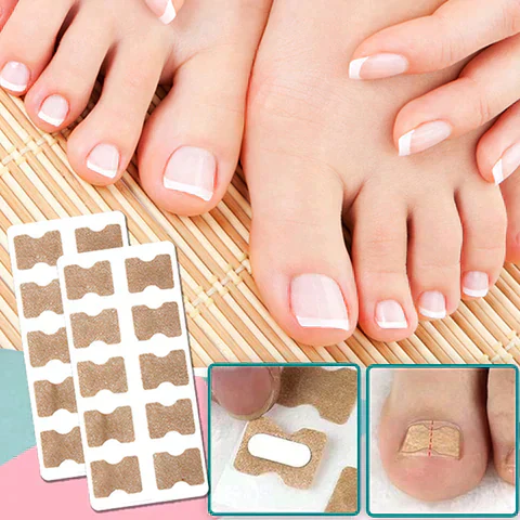 NailHeal™ 50+50 Stück GRATIS – Sofortige Schmerzlinderung und schnellere Heilung beschädigter Nägel! - Image 5