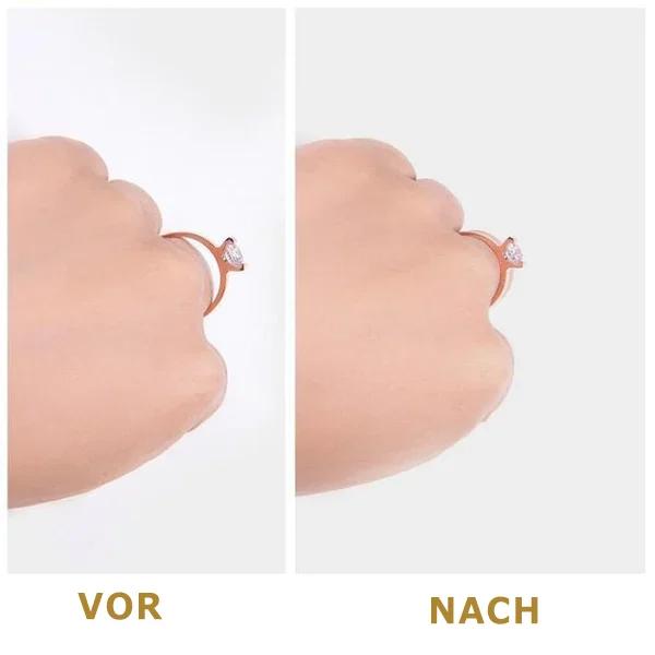 Ringgrößenversteller™ | 50% RABATT - Image 6