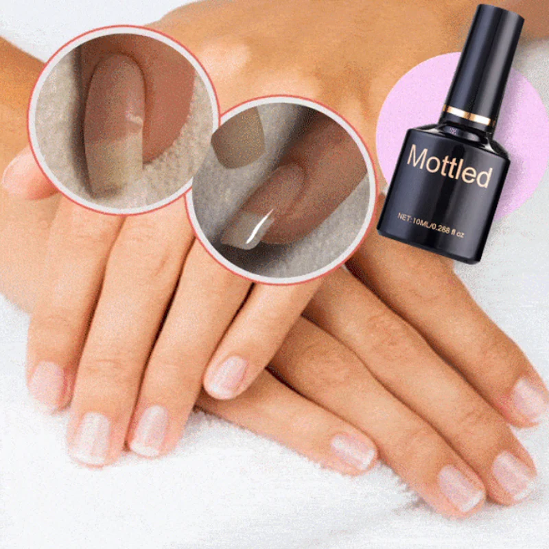 NailRescue - Schutzgel für die Nagelreparatur | 50% RABATT - Image 5