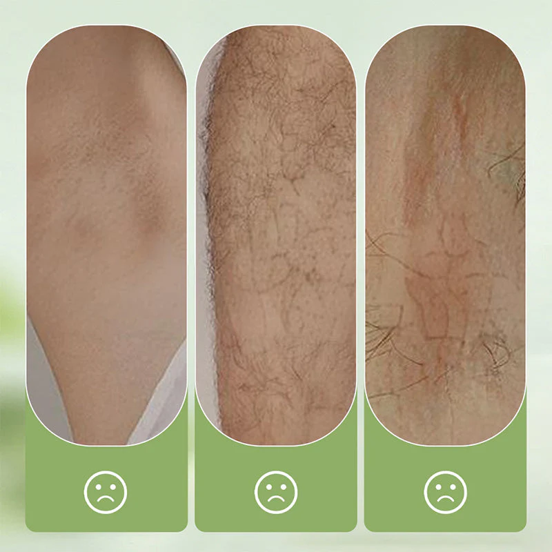 SilkPure 250 g — Sanfte Enthaarungscreme | 1+1 GRATIS - Image 14