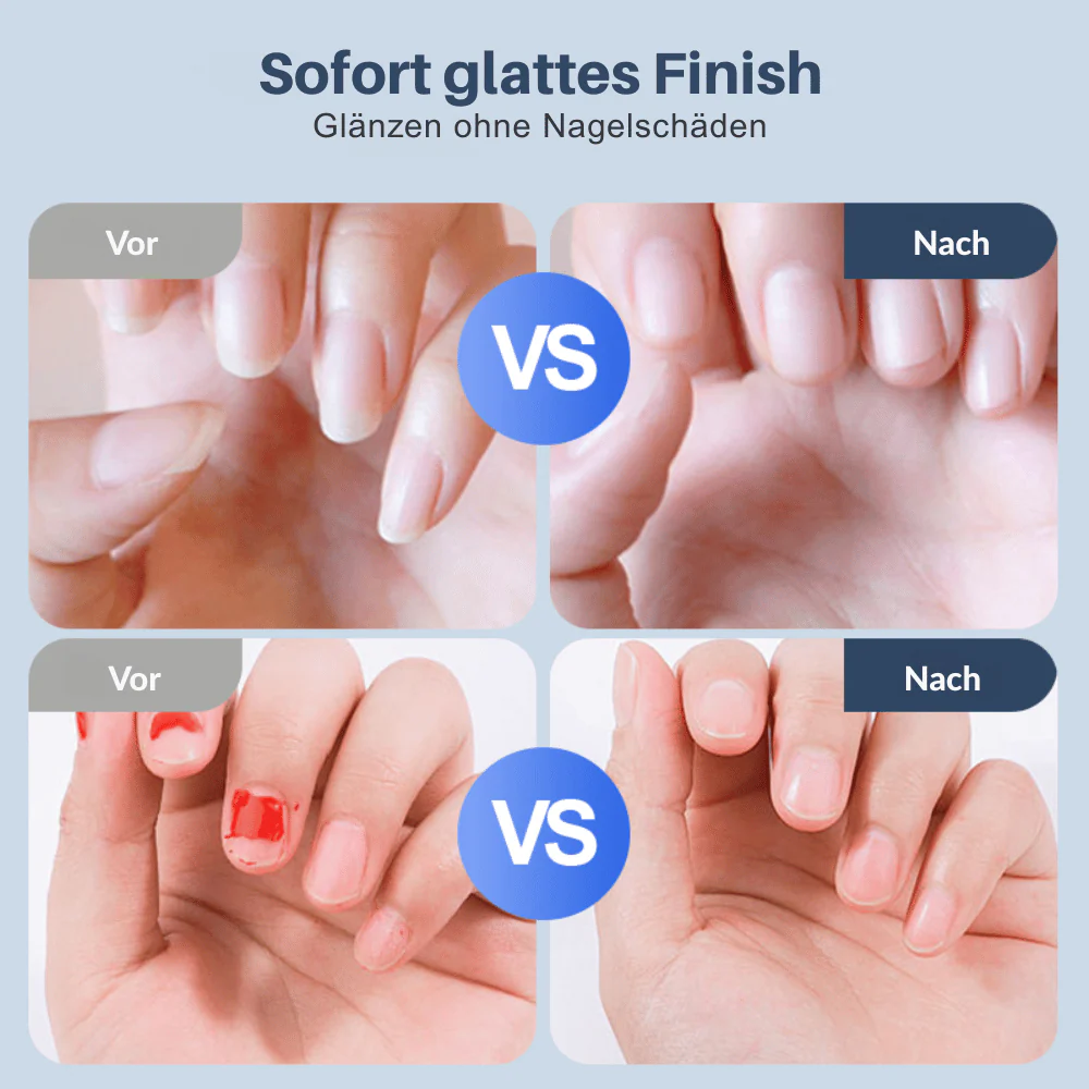 SilentSculpt — Elektrische Nagelfeile | 50% RABATT - Image 2