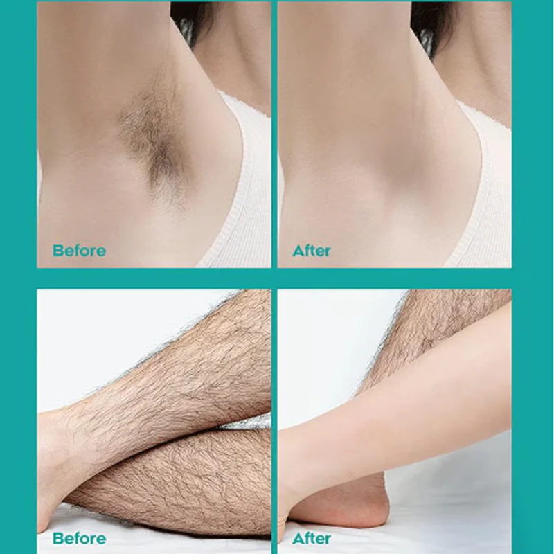 SilkenEase — Sanfte Haarentfernung Creme | 1+1 GRATIS - Image 9