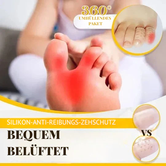 SoftEase – Atmungsaktive Zehenschützer | 50% RABATT - Image 3