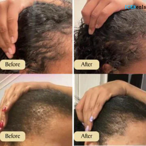GrowthGlow - Pflanzliche Formel mit mehr als 10 Ölen für intensive Feuchtigkeitszufuhr und Schutz | 1+1 GRATIS - Image 4