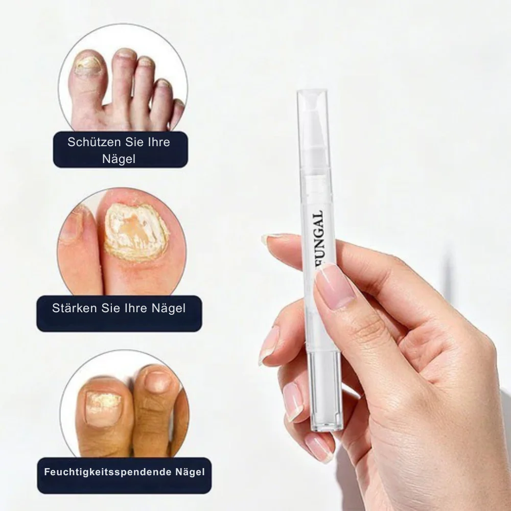 StrongNail – Präzise Nagelpflege | 1+1 GRATIS - Image 4