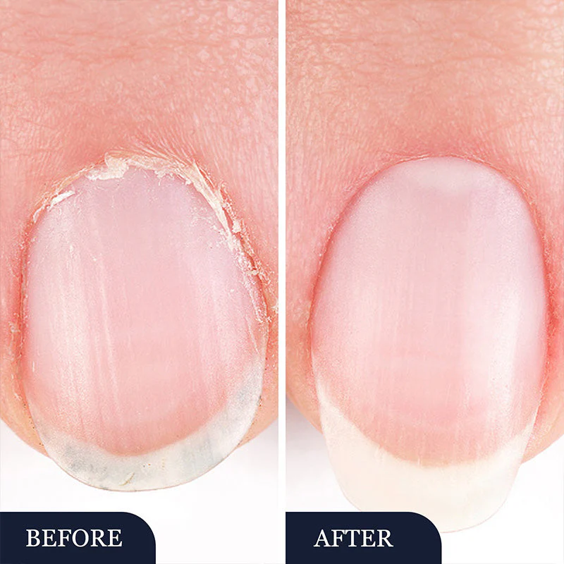 StrongNail – Präzise Nagelpflege | 1+1 GRATIS - Image 8