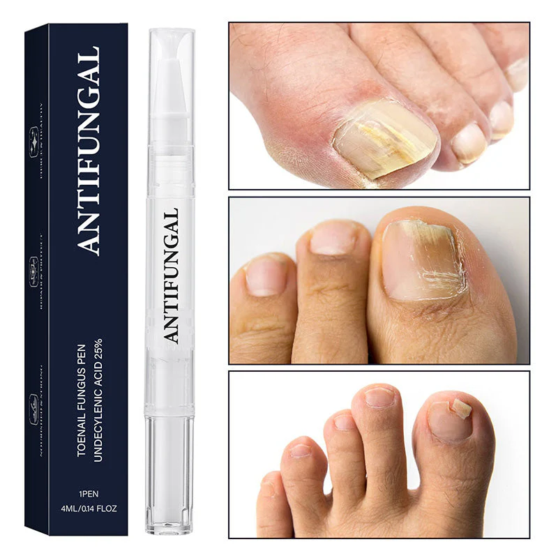 StrongNail – Präzise Nagelpflege | 1+1 GRATIS - Image 9